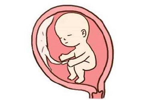 美国试管专家解析：如何预防卵巢过度刺激及应对措施