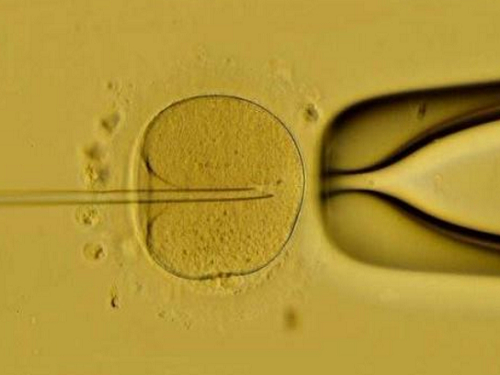试管婴儿为什么要培养囊胚，有什么优点？